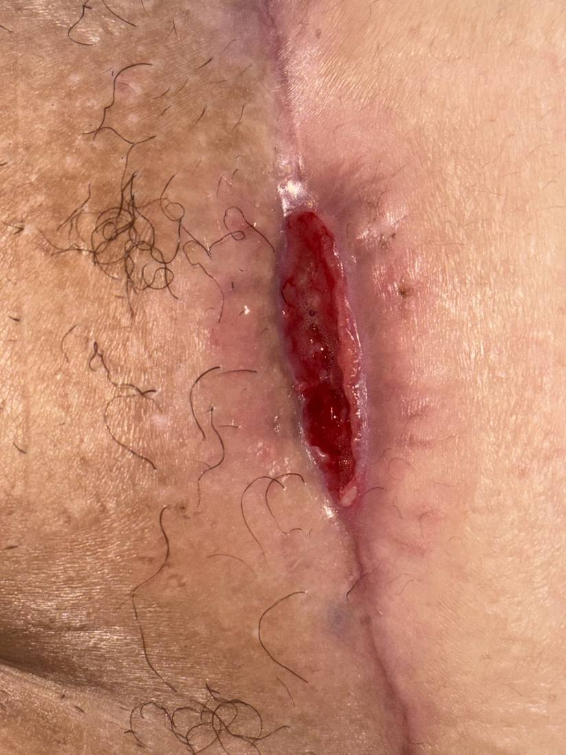 06/01/26